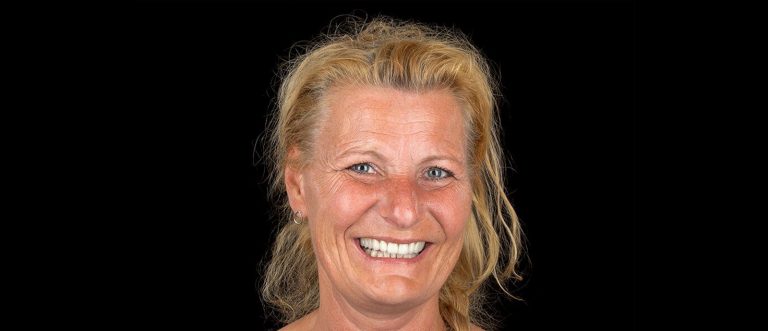 Klinicki slucaj - pacijent Anja | DSA Digital Smile Academy