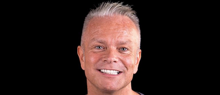 Klinicki slucaj - pacijent Jimmy | DSA Digital Smile Academy